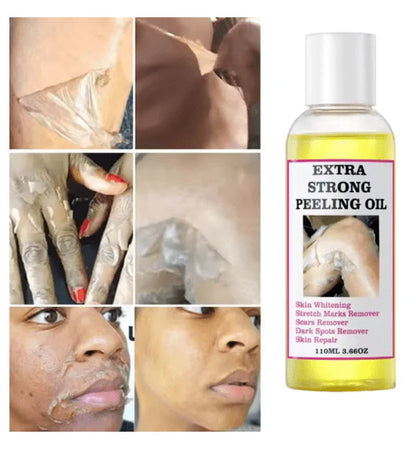Peeling Oil
