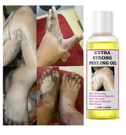 Peeling Oil